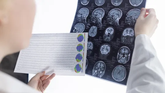 Máster en Neurociencias