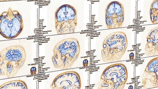 Portada III Jornadas de la Cátedra VIU-NED en Neurociencia Global y Cambio Social