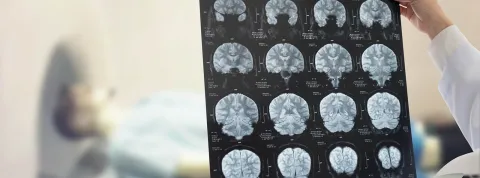 Máster Universitario en Neuropsicología.jpg