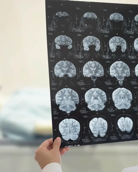 Máster Universitario en Neuropsicología.jpg